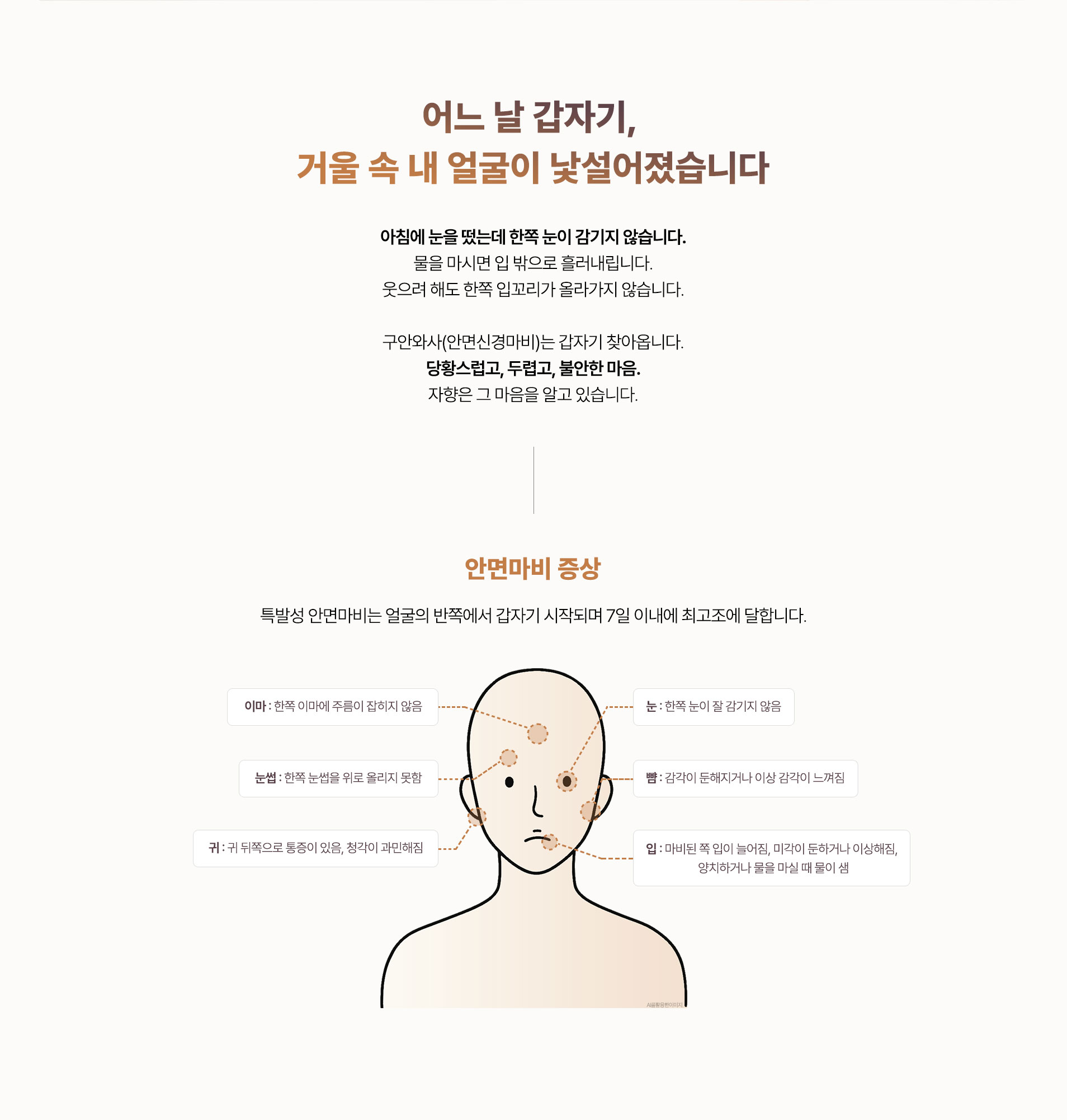 특발성 안면마비는 얼굴의 반쪽에서 갑자기 시작되며 7일 이내에 최고조로 달합니다.