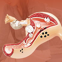 부인과 수술 후 입원·외래