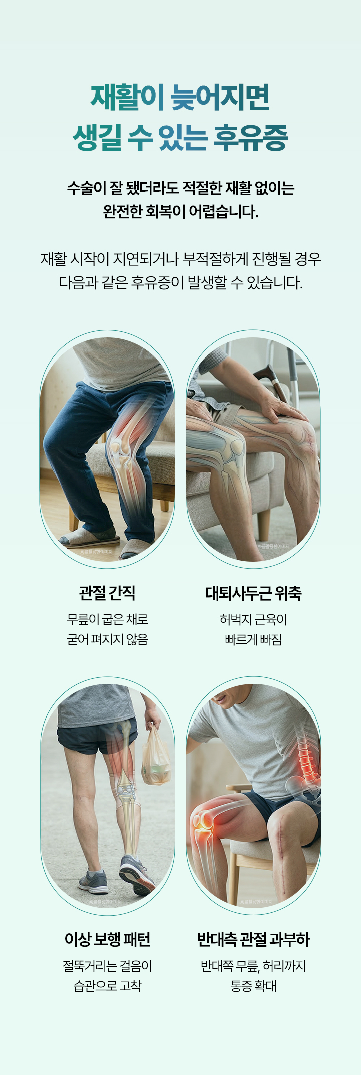수술이 잘 됐더라도 적절한 재활 없이는 완전한 회복이 어렵습니다. 관절 강직, 대퇴사두근 위축, 이상 보행 패턴, 반대측 관절 과부화