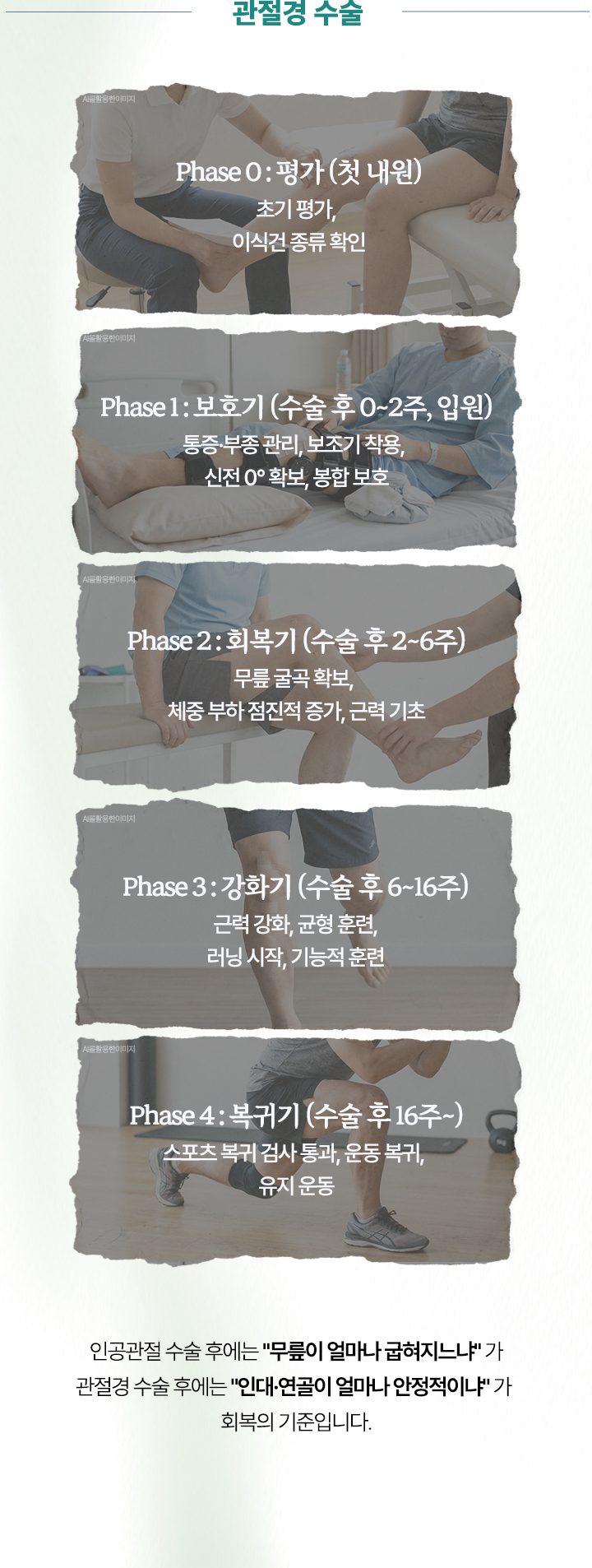 인공 관절 수술 : 급성기, 회복기, 강화기, 복귀기. 관절경 수술 : 평가, 보호기, 회복기, 강화기, 복귀기
