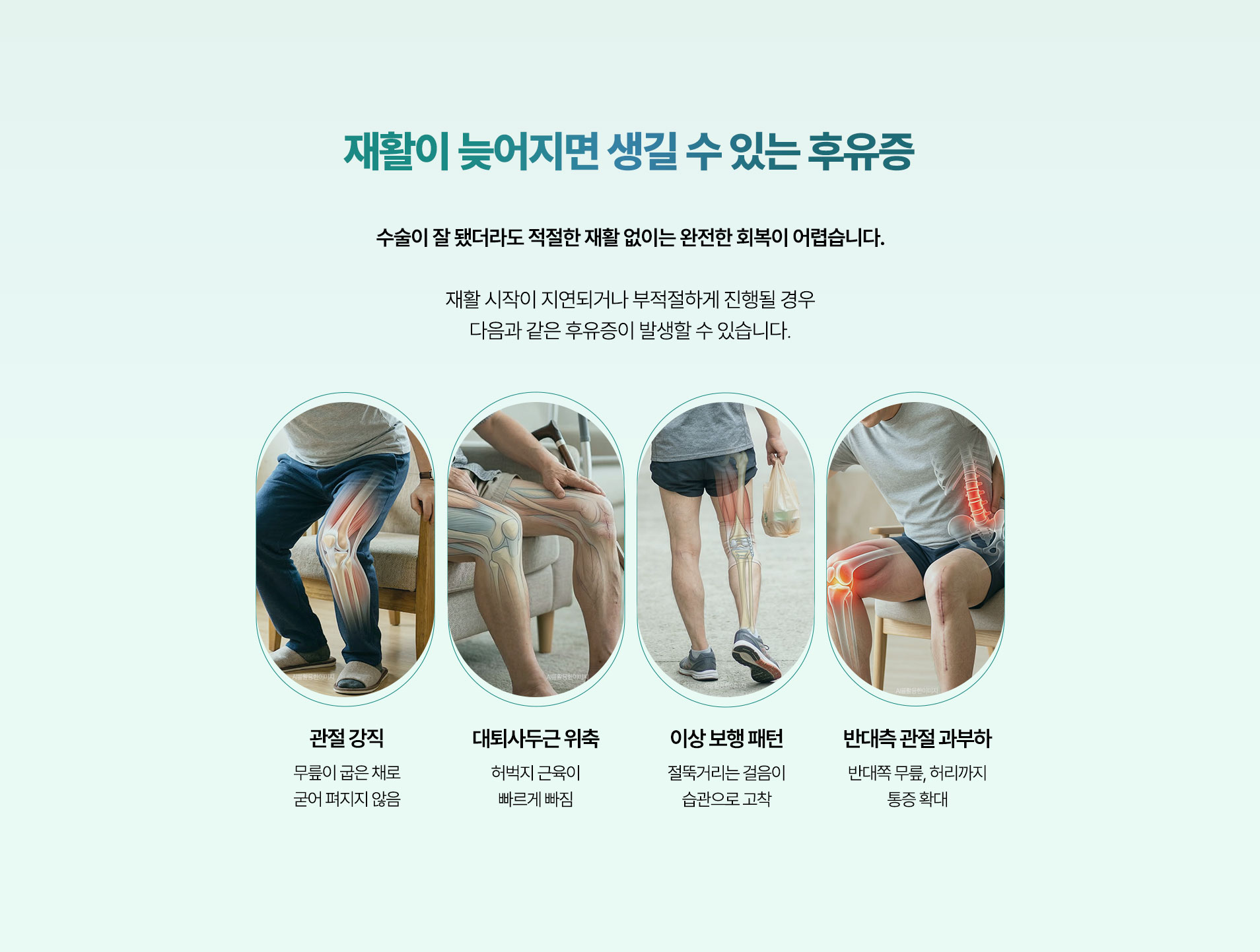 수술이 잘 됐더라도 적절한 재활 없이는 완전한 회복이 어렵습니다. 관절 강직, 대퇴사두근 위축, 이상 보행 패턴, 반대측 관절 과부화