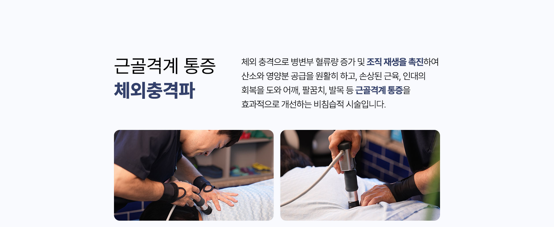 근골격계 통증 체외충격파, 체외 충격으로 조직 재생을 촉진하여 근골격계 통증을 개선하는 비침습적 시술